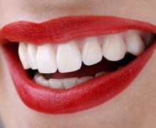 Acqua ossigenata sui denti: gli effetti collaterali