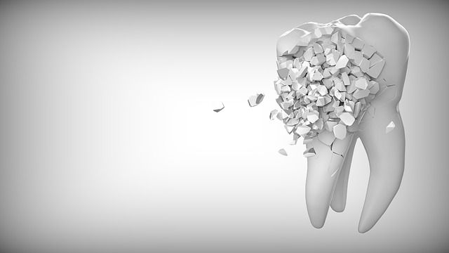 Cosa fare se un dente fa male?